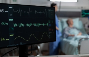 ecg